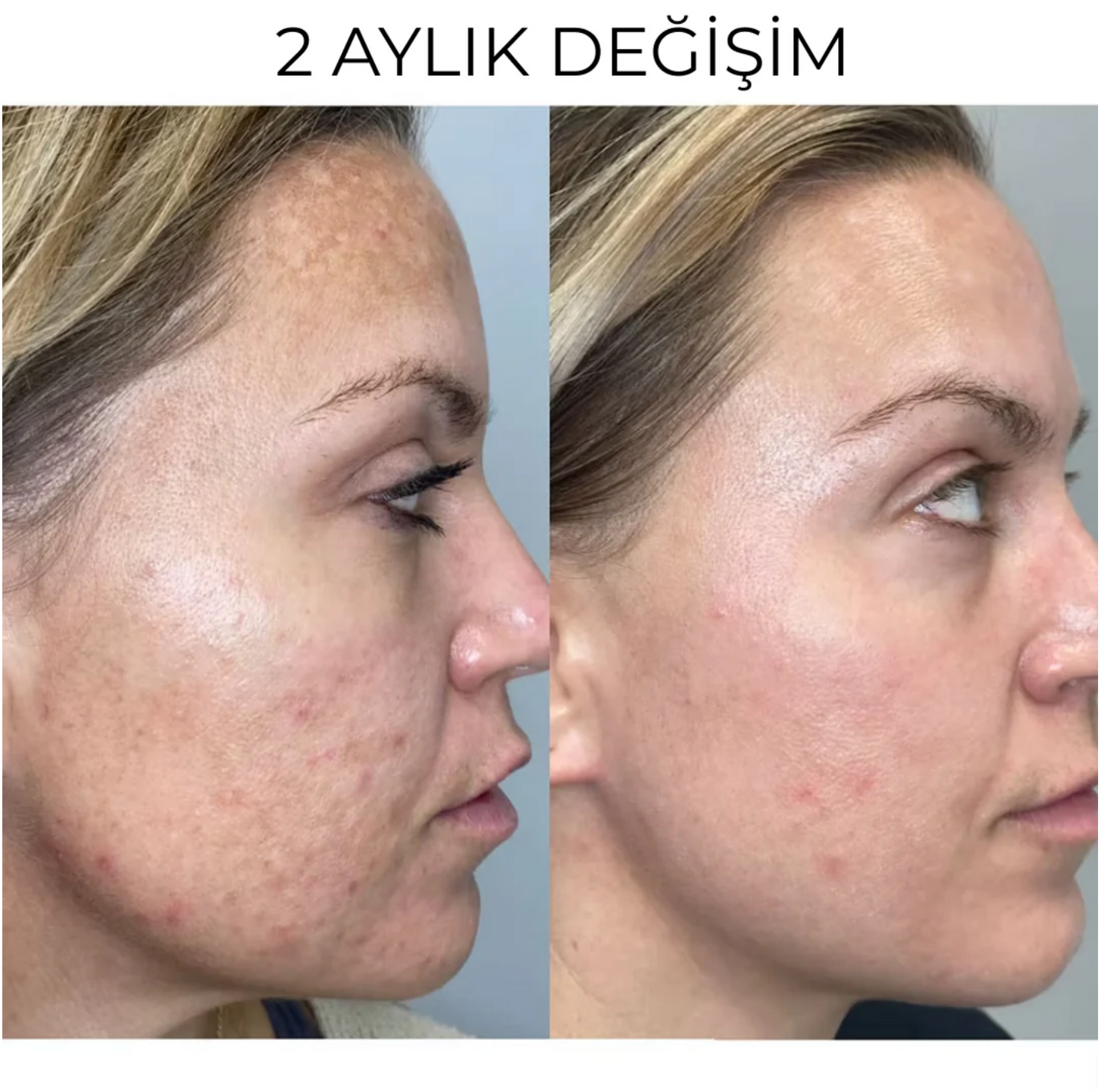 Liarina® Kuyruk Yağı & Bal Özü Krem